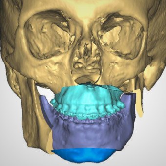 Animation of skull and mouth highlighted blue