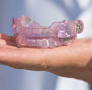 Hand holding an oral appliance