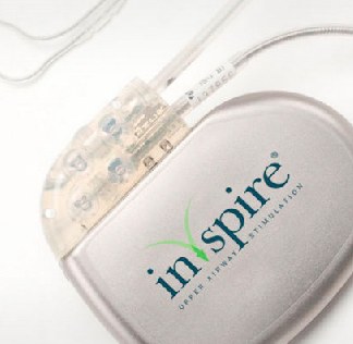 Inspire system kit