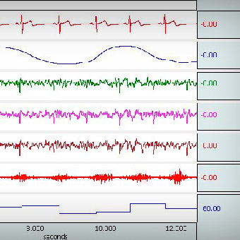 Polysomnography report