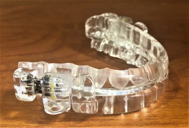 a sleep apnea oral appliance 